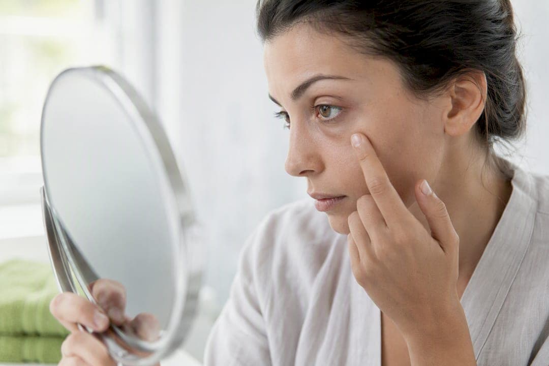 Ojeras pigmentadas: causas reales y cómo tratarlas con criterio